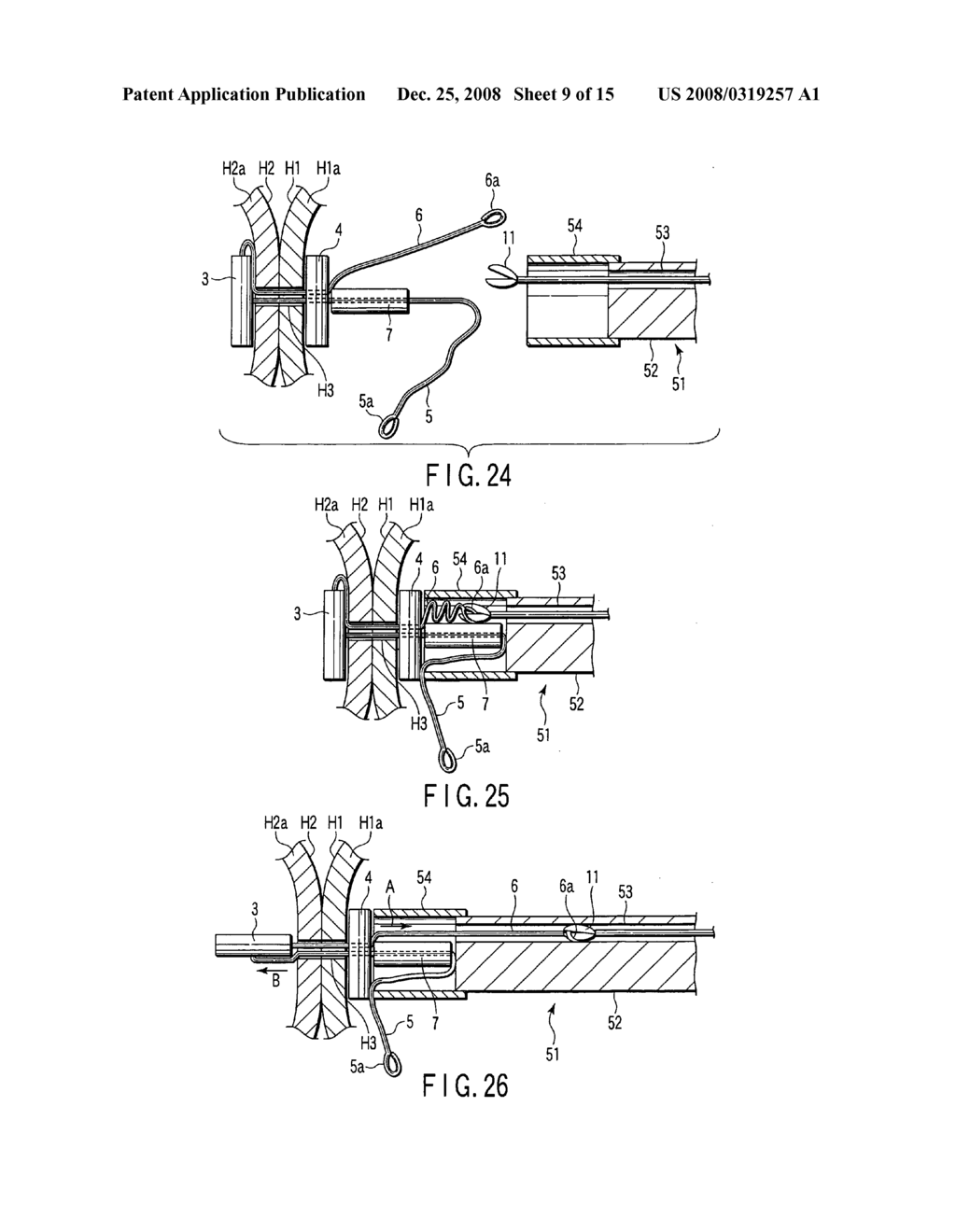 Living body wall fixing tool used in endoscope - diagram, schematic, and image 10