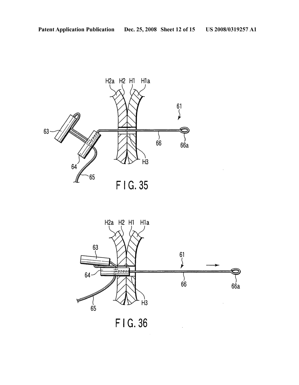 Living body wall fixing tool used in endoscope - diagram, schematic, and image 13