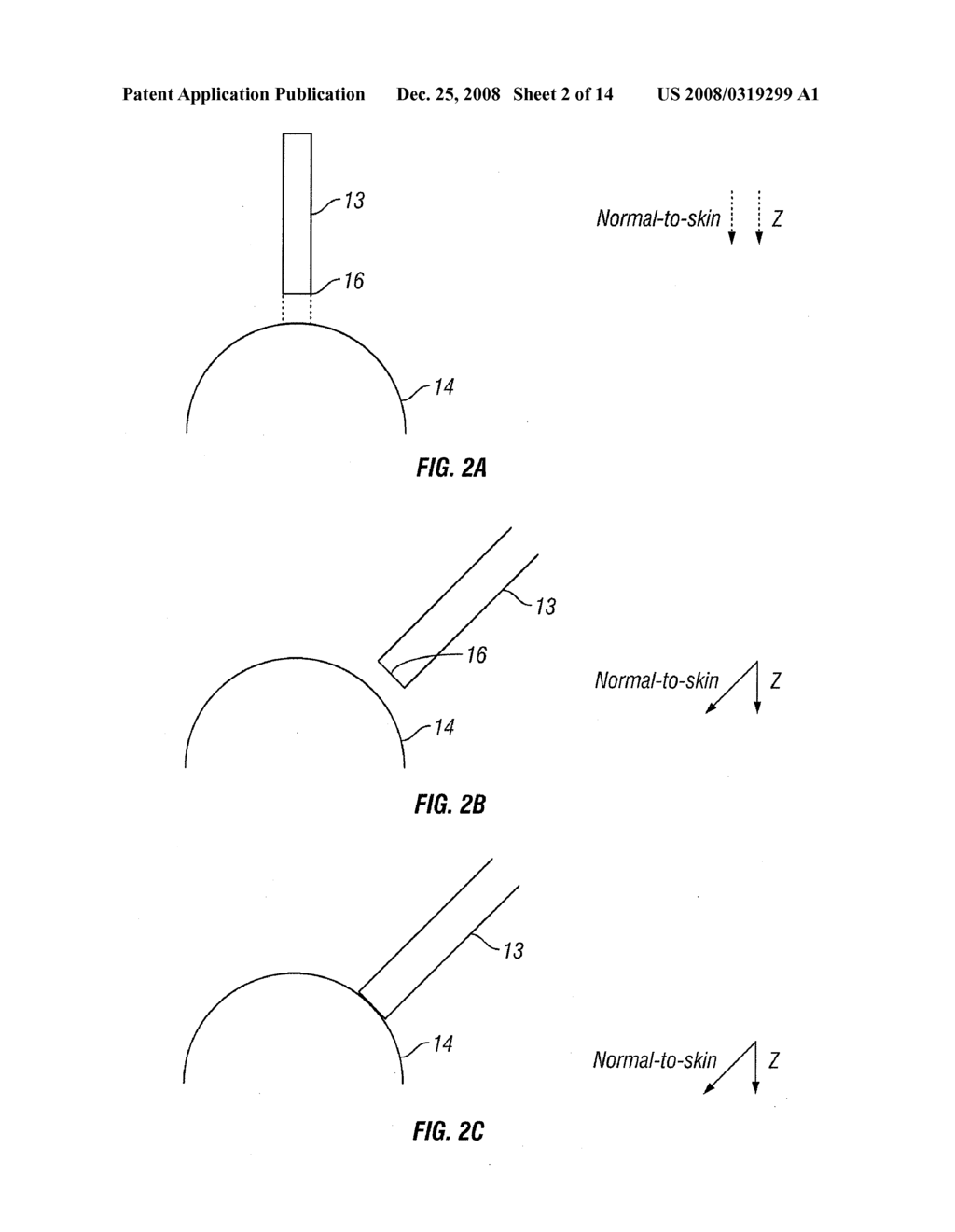 METHOD AND APPARATUS FOR CONTROLLING POSITIONING OF A NONINVASIVE ANALYZER SAMPLE PROBE - diagram, schematic, and image 03