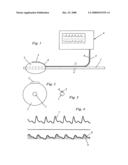 Measuring Member And Device For Determining The Blood Flow Of The Gastrointestinal Tract, As Well As For Registrating The Intestinal Peristalsis diagram and image