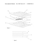 Orthopedic System for Immobilizing and Supporting Body Parts diagram and image