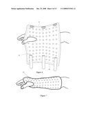 Orthopedic System for Immobilizing and Supporting Body Parts diagram and image