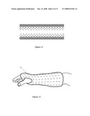 Orthopedic System for Immobilizing and Supporting Body Parts diagram and image