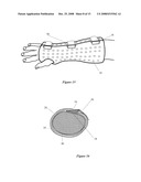 Orthopedic System for Immobilizing and Supporting Body Parts diagram and image