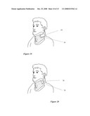 Orthopedic System for Immobilizing and Supporting Body Parts diagram and image