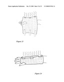 Orthopedic System for Immobilizing and Supporting Body Parts diagram and image