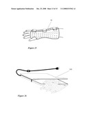 Orthopedic System for Immobilizing and Supporting Body Parts diagram and image