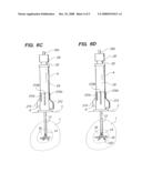 PERCUTANEOUS ARRAY DELIVERY SYSTEM diagram and image