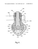 SYSTEM AND METHOD FOR FACET JOINT REPLACEMENT WITH DETACHABLE COUPLER diagram and image