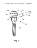 SYSTEM AND METHOD FOR FACET JOINT REPLACEMENT WITH DETACHABLE COUPLER diagram and image