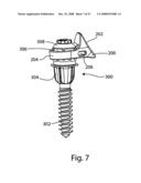 SYSTEM AND METHOD FOR FACET JOINT REPLACEMENT WITH DETACHABLE COUPLER diagram and image