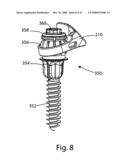 SYSTEM AND METHOD FOR FACET JOINT REPLACEMENT WITH DETACHABLE COUPLER diagram and image