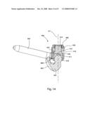 SYSTEM AND METHOD FOR FACET JOINT REPLACEMENT WITH DETACHABLE COUPLER diagram and image