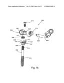 SYSTEM AND METHOD FOR FACET JOINT REPLACEMENT WITH DETACHABLE COUPLER diagram and image