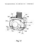 SYSTEM AND METHOD FOR FACET JOINT REPLACEMENT WITH DETACHABLE COUPLER diagram and image