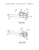 SYSTEM AND METHOD FOR FACET JOINT REPLACEMENT WITH DETACHABLE COUPLER diagram and image