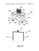 SYSTEM AND METHOD FOR FACET JOINT REPLACEMENT WITH DETACHABLE COUPLER diagram and image