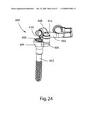 SYSTEM AND METHOD FOR FACET JOINT REPLACEMENT WITH DETACHABLE COUPLER diagram and image