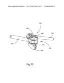 SYSTEM AND METHOD FOR FACET JOINT REPLACEMENT WITH DETACHABLE COUPLER diagram and image