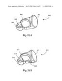 SYSTEM AND METHOD FOR FACET JOINT REPLACEMENT WITH DETACHABLE COUPLER diagram and image