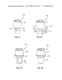 SYSTEM AND METHOD FOR FACET JOINT REPLACEMENT WITH DETACHABLE COUPLER diagram and image