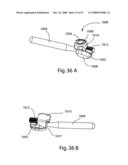 SYSTEM AND METHOD FOR FACET JOINT REPLACEMENT WITH DETACHABLE COUPLER diagram and image