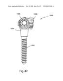 SYSTEM AND METHOD FOR FACET JOINT REPLACEMENT WITH DETACHABLE COUPLER diagram and image