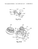 SYSTEM AND METHOD FOR FACET JOINT REPLACEMENT WITH DETACHABLE COUPLER diagram and image