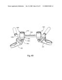 SYSTEM AND METHOD FOR FACET JOINT REPLACEMENT WITH DETACHABLE COUPLER diagram and image