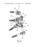 SYSTEM AND METHOD FOR IMPLANT ANCHORAGE WITH ANTI-ROTATION FEATURES diagram and image