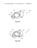 SYSTEM AND METHOD FOR IMPLANT ANCHORAGE WITH ANTI-ROTATION FEATURES diagram and image