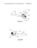 SYSTEM AND METHOD FOR IMPLANT ANCHORAGE WITH ANTI-ROTATION FEATURES diagram and image