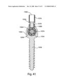 SYSTEM AND METHOD FOR IMPLANT ANCHORAGE WITH ANTI-ROTATION FEATURES diagram and image