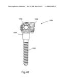 SYSTEM AND METHOD FOR IMPLANT ANCHORAGE WITH ANTI-ROTATION FEATURES diagram and image