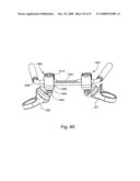 SYSTEM AND METHOD FOR IMPLANT ANCHORAGE WITH ANTI-ROTATION FEATURES diagram and image