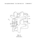 Methods and Devices for Controlled Flexion Restriction of Spinal Segments diagram and image