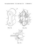 Methods and Devices for Controlled Flexion Restriction of Spinal Segments diagram and image