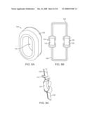 Methods and Devices for Controlled Flexion Restriction of Spinal Segments diagram and image