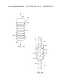 Methods and Devices for Controlled Flexion Restriction of Spinal Segments diagram and image