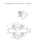 Methods and Devices for Controlled Flexion Restriction of Spinal Segments diagram and image