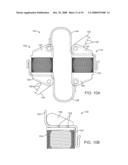 Methods and Devices for Controlled Flexion Restriction of Spinal Segments diagram and image