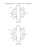 Methods and Devices for Controlled Flexion Restriction of Spinal Segments diagram and image