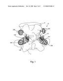 SYSTEM AND METHOD FOR FACET JOINT REPLACEMENT diagram and image