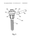 SYSTEM AND METHOD FOR FACET JOINT REPLACEMENT diagram and image