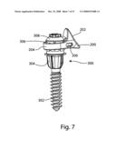 SYSTEM AND METHOD FOR FACET JOINT REPLACEMENT diagram and image