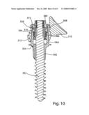 SYSTEM AND METHOD FOR FACET JOINT REPLACEMENT diagram and image