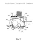 SYSTEM AND METHOD FOR FACET JOINT REPLACEMENT diagram and image