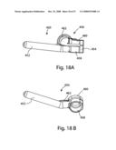 SYSTEM AND METHOD FOR FACET JOINT REPLACEMENT diagram and image