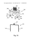 SYSTEM AND METHOD FOR FACET JOINT REPLACEMENT diagram and image