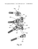 SYSTEM AND METHOD FOR FACET JOINT REPLACEMENT diagram and image